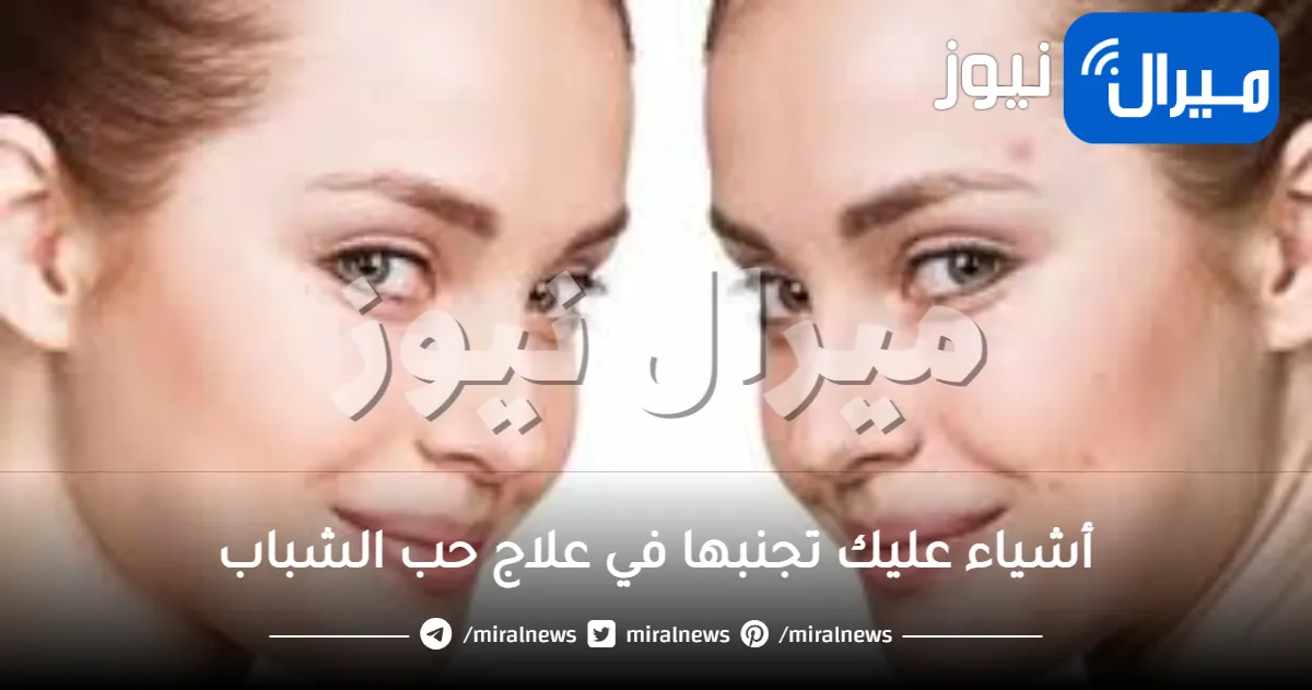 أشياء عليك تجنبها في علاج حب الشباب