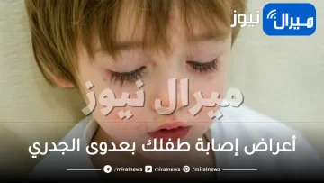 أعراض إصابة طفلك بعدوى الجدري ومضاعفات المرض