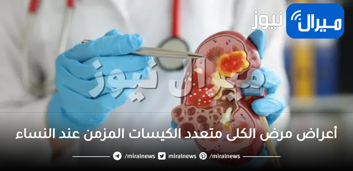 أعراض مرض الكلى متعدد الكيسات المزمن عند النساء