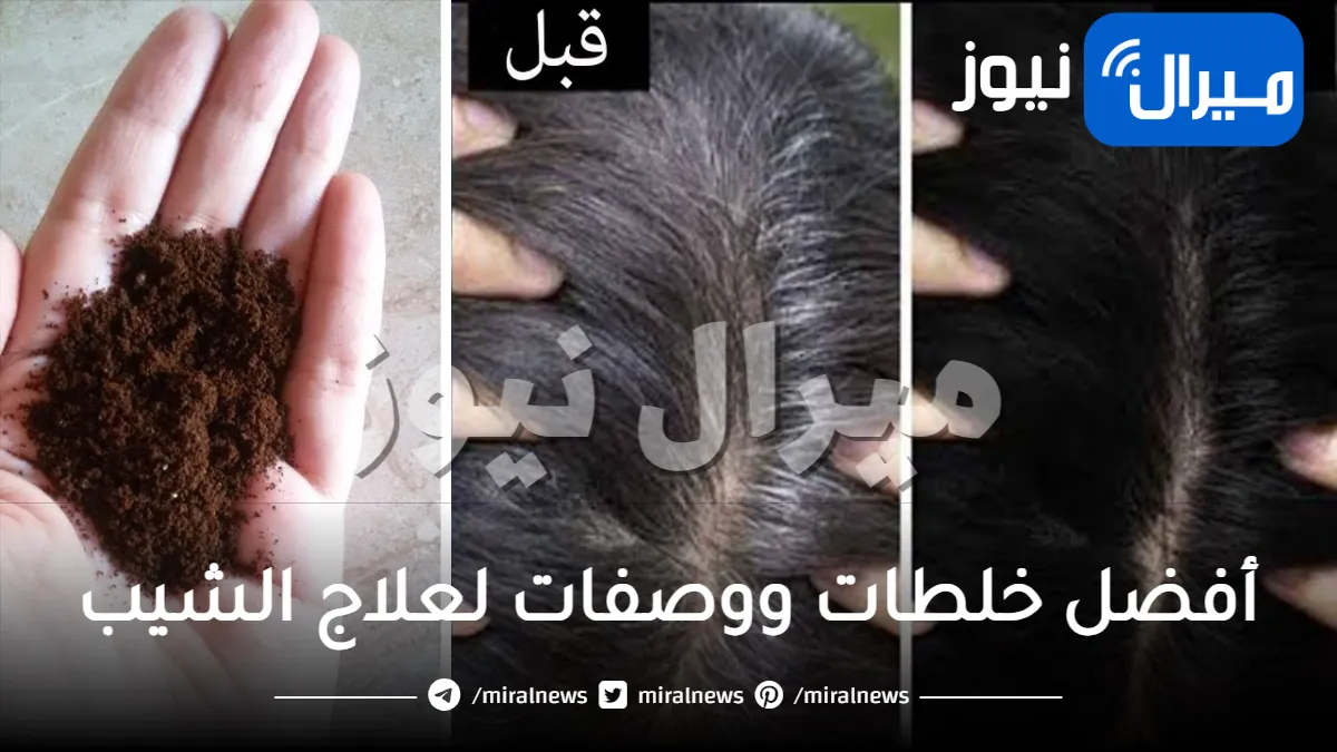 6 أفضل وصفات لعلاج الشيب | الشعر الابيض