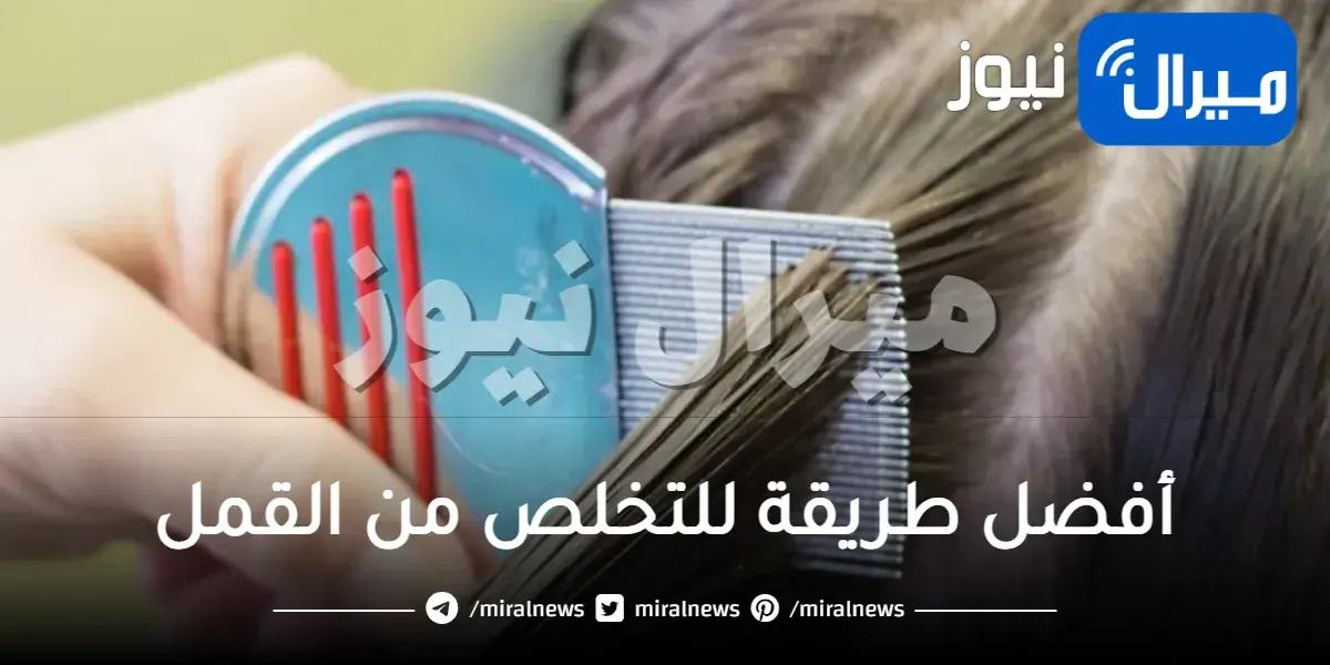 أفضل طريقة للتخلص من القمل في البيت بالخل من أول مرة في يوم واحد