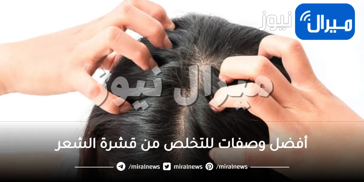 8 أسرع وصفات لعلاج قشرة الشعر