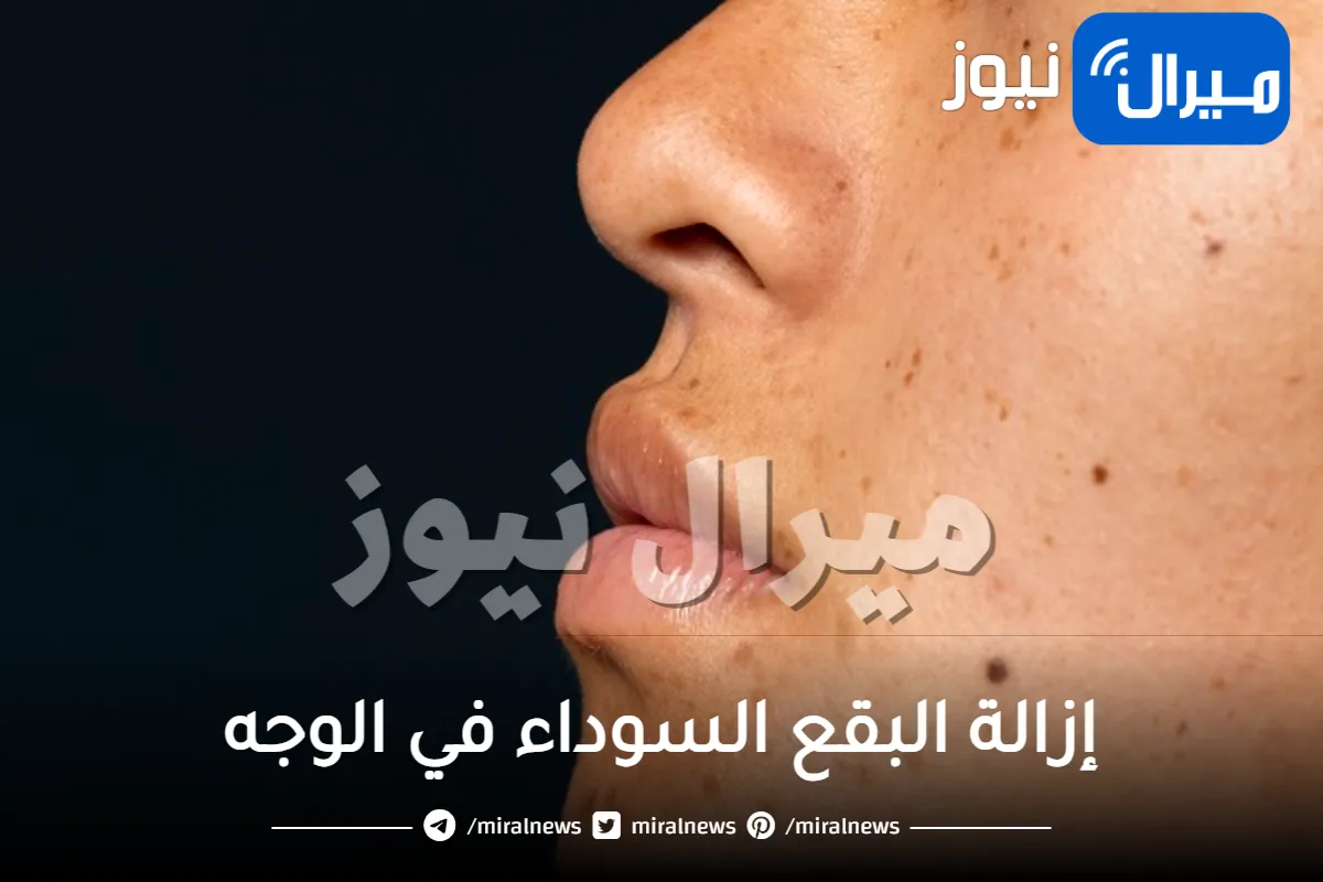 16 علاج لإزالة البقع السوداء في الوجه