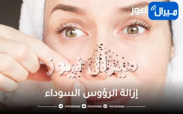 15 علاج لإزالة الرؤوس السوداء