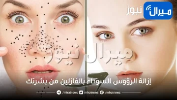 إزالة الرؤوس السوداء بالفازلين من بشرتك