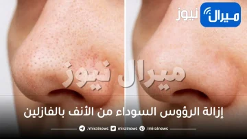 إزالة الرؤوس السوداء من الأنف بالفازلين