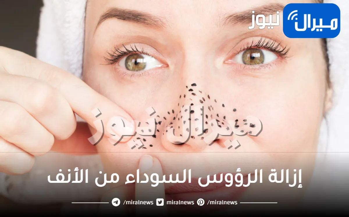 إزالة الرؤوس السوداء من الأنف.. طرق مختلفة وسريعة