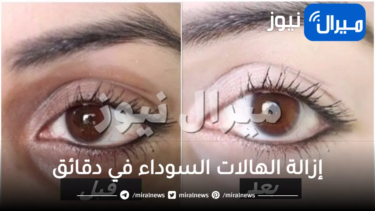إزالة الهالات السوداء في دقائق