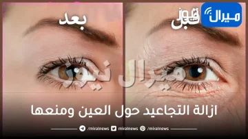 كيفية ازالة التجاعيد حول العين