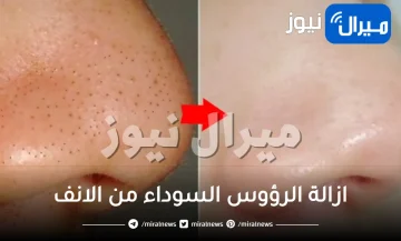 ازالة الرؤوس السوداء من الانف .. 4 طرق