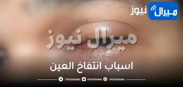 اسباب انتفاخ العين وطرق العلاج