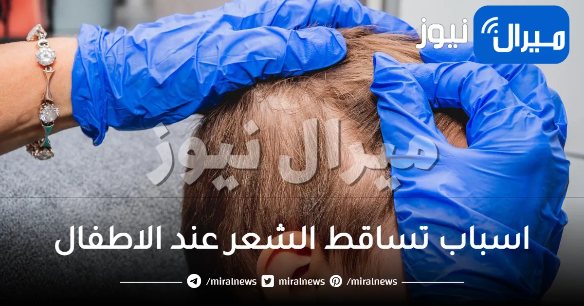 ماهي اسباب تساقط الشعر عند الاطفال؟