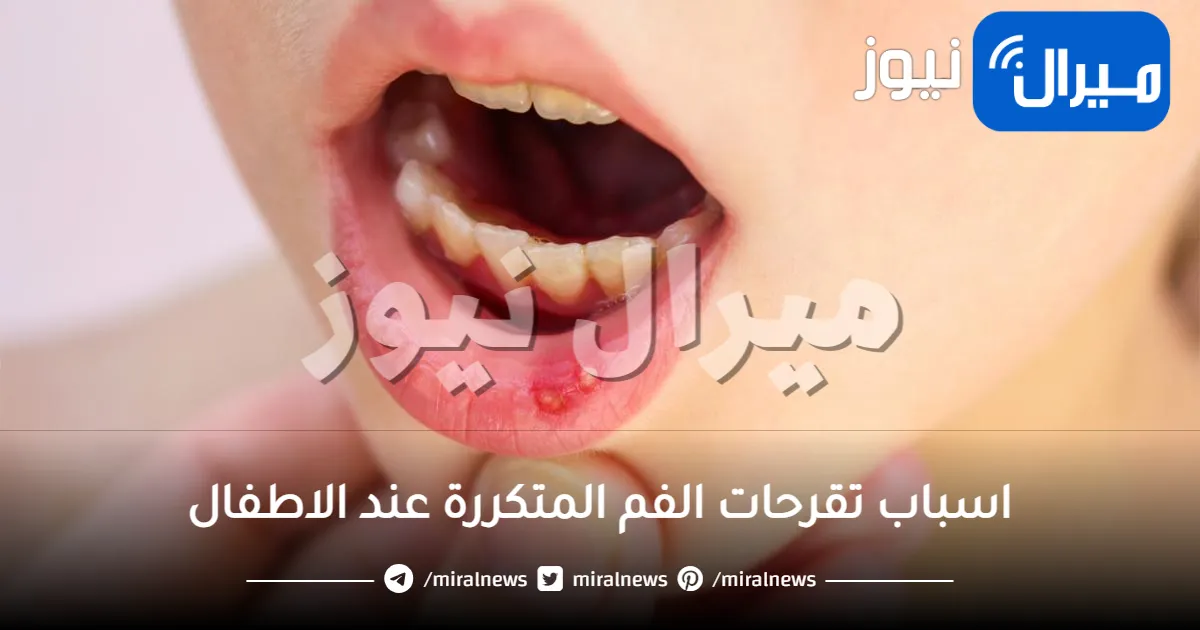اسباب تقرحات الفم المتكررة عند الاطفال
