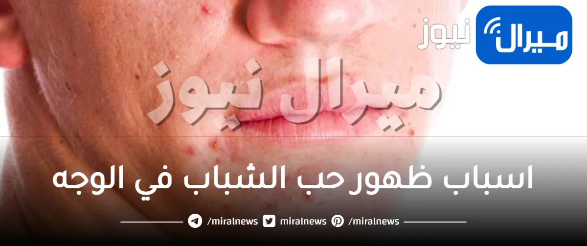 ماهي اسباب ظهور حب الشباب في الوجه؟
