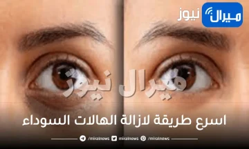 اسرع طريقة لازالة الهالات السوداء فى يومين