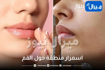 اسمرار منطقة حول الفم.. أسبابها وطرق العناية بها