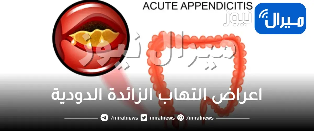 اعراض التهاب الزائدة الدودية ( الأعراض والتشخيص )
