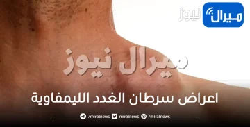 اعراض سرطان الغدد الليمفاوية