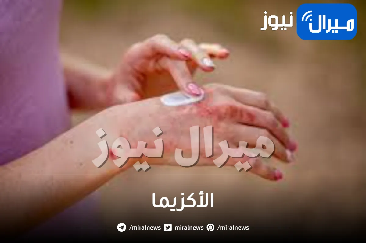 6 أمور تجعل الأكزيما بحالة سيئة