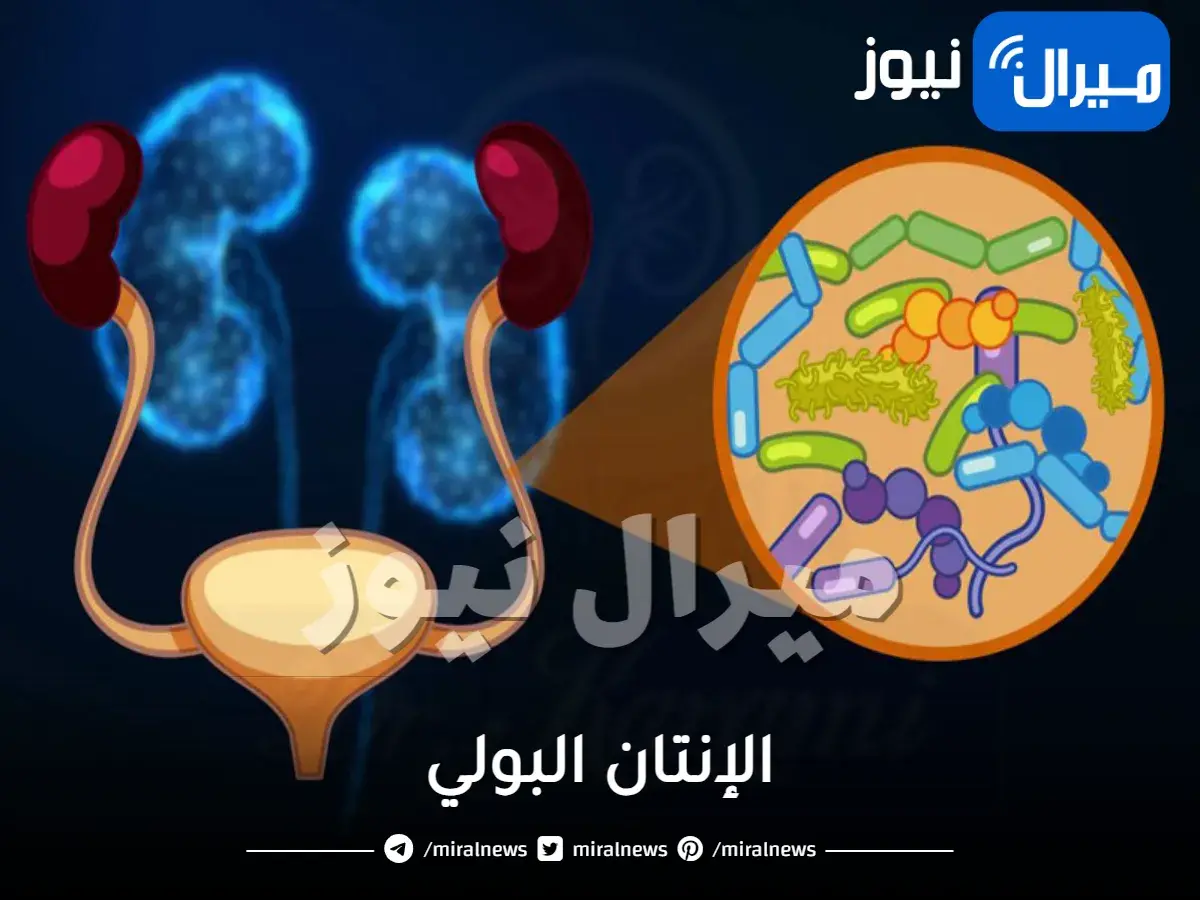 الإنتان البولي