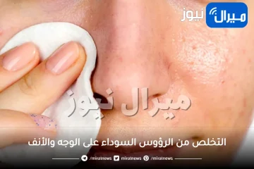 أسهل الطرق للتخلص من الرؤوس السوداء على الوجه والأنف