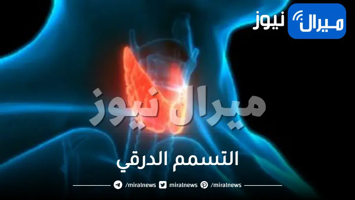 التسمم الدرقي واعراضه وخطورته وعلاجه