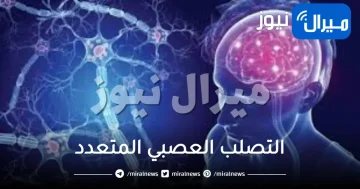 تشخيص مرض التصلب العصبي المتعدد