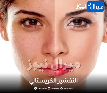 التقشير الكريستالي .. إليكِ المعلومات الكاملة والمفصلة عنه