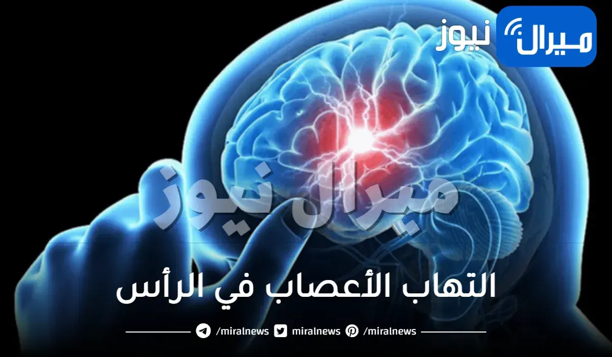 أدوية علاج التهاب الأعصاب في الرأس
