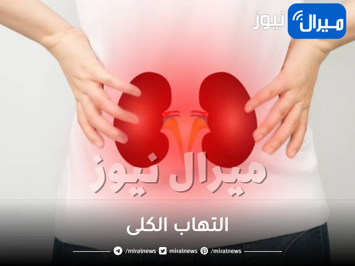 التهاب الكلى واعراضه واسبابه وكيفية علاجه