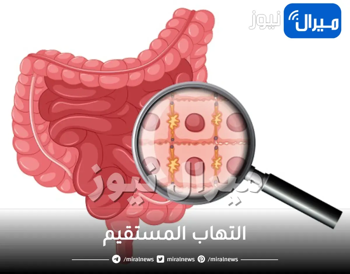 ما هو التهاب المستقيم واعراضه واسبابه