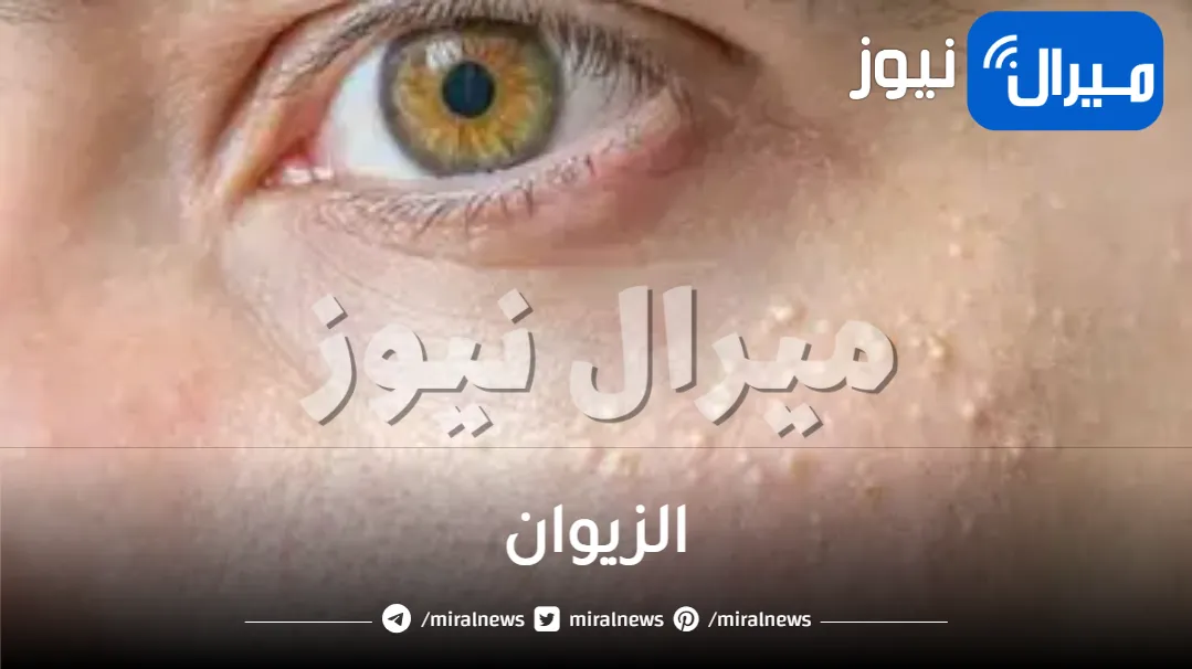 الزيوان