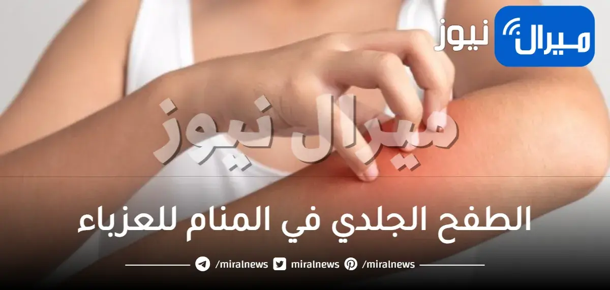 الطفح الجلدي في المنام للعزباء