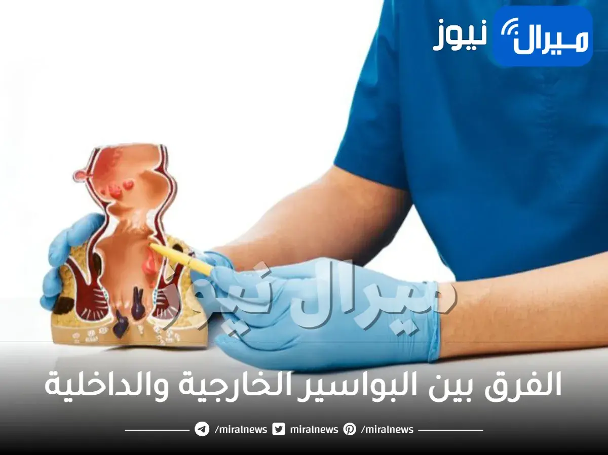 الفرق بين البواسير الخارجية والداخلية