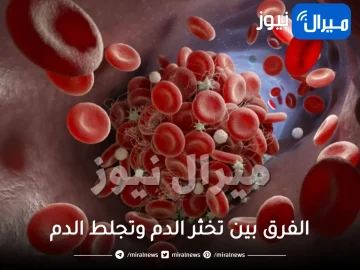 الفرق بين تخثر الدم وتجلط الدم أيهما أخطر ويؤدي إلى الوفاة !!