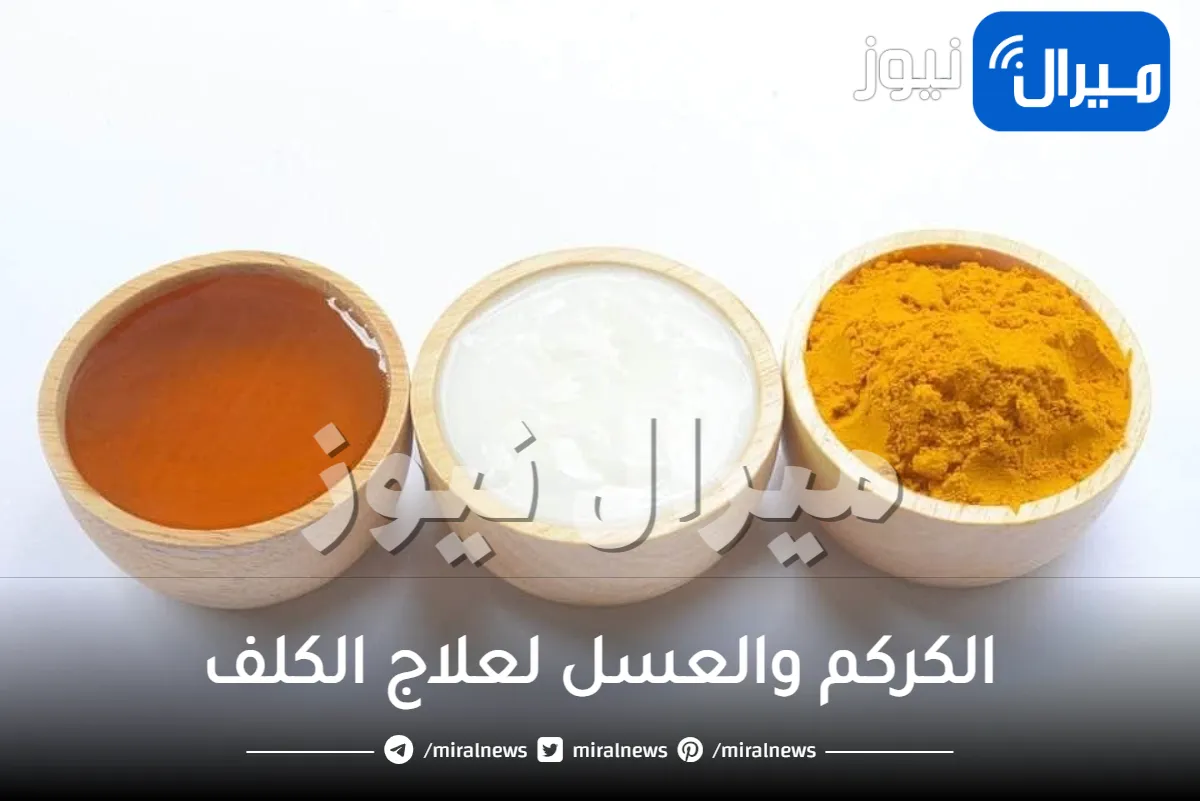 الكركم والعسل لعلاج الكلف