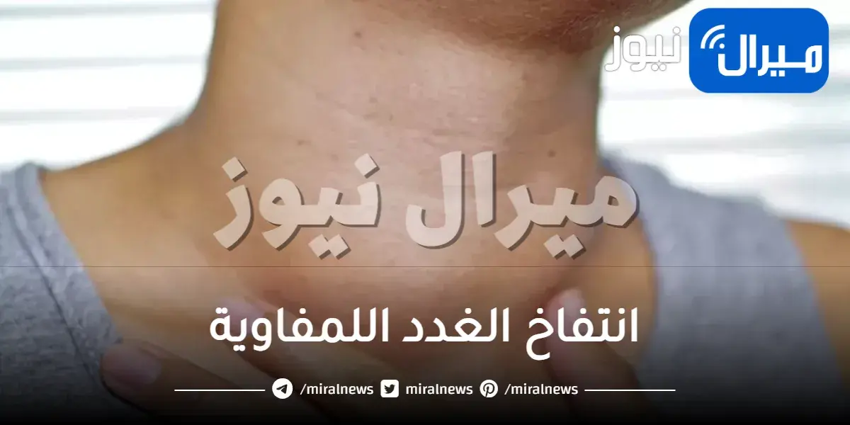 انتفاخ الغدد اللمفاوية