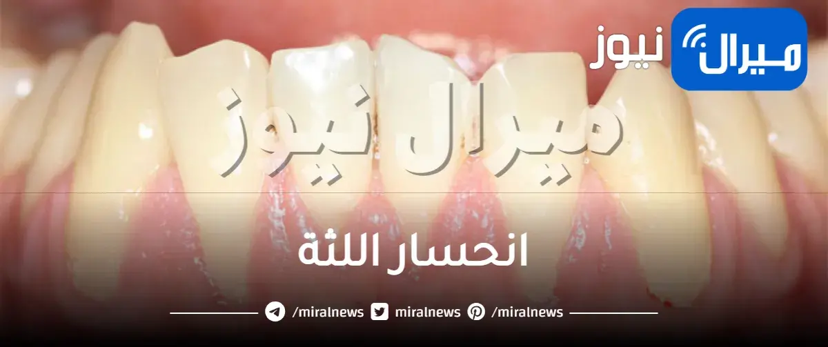 انحسار اللثة واسبابه واعراضه والعلاج