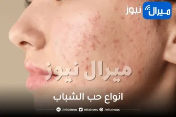انواع حب الشباب وما هي أعراضه وكيفية علاجه