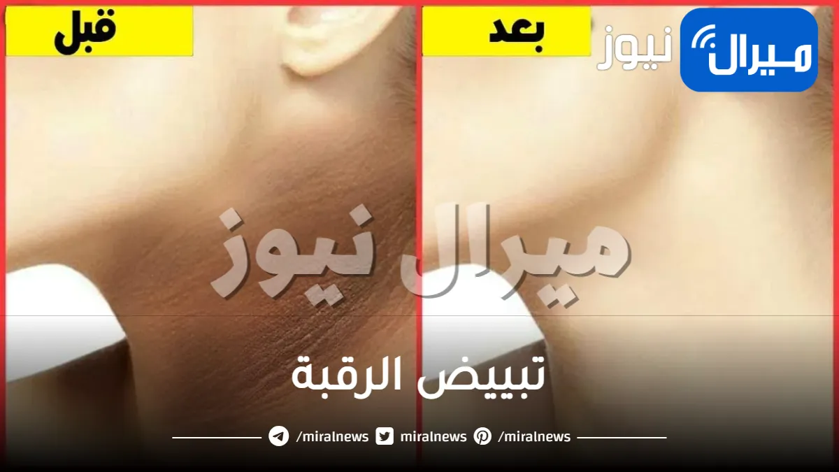 تبييض الرقبة في 3 ايام