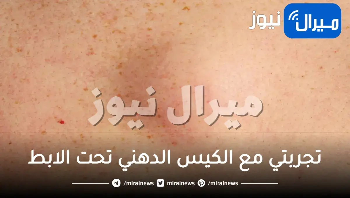 تجربتي مع الكيس الدهني تحت الابط متى يكون وجوده مؤشر خطر وكيفية التخلص منه