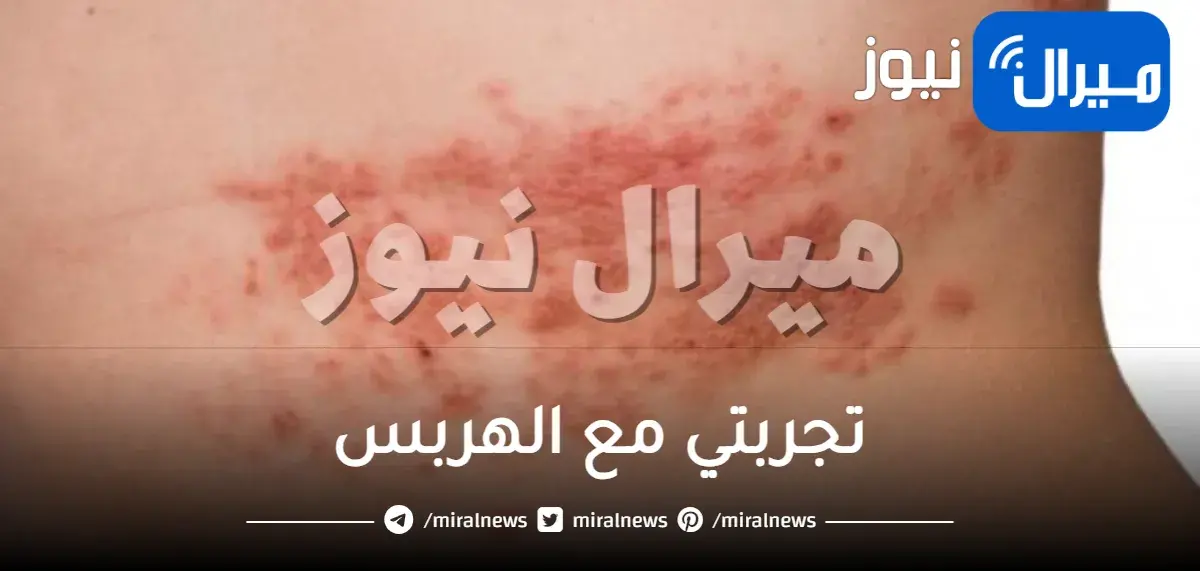 تجربتي مع الهربس الفموي و مرض الهربس الجلدي