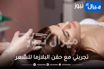 تجربتي مع حقن البلازما للشعر