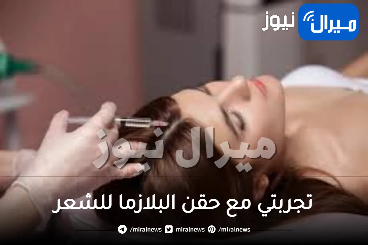 تجربتي مع حقن البلازما للشعر