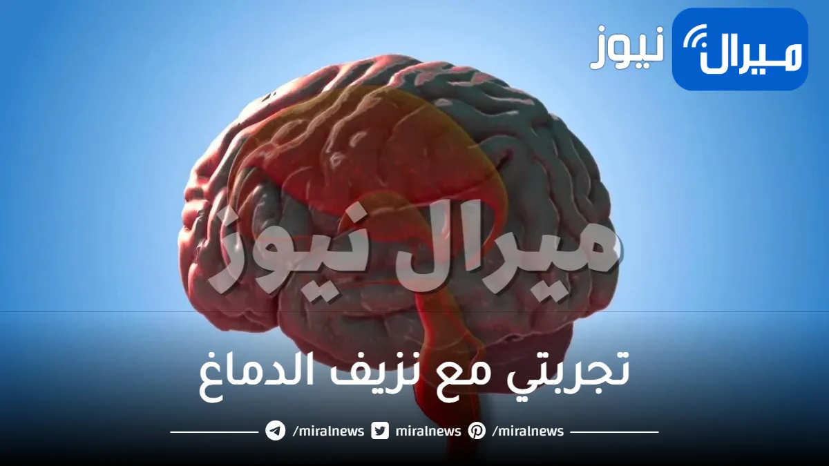 تجربتي مع نزيف الدماغ