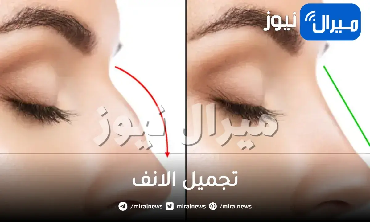 أسعار تجميل الانف في مصر