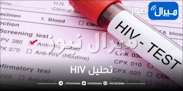 هل يظهر الإيدز في تحليل الدم العادي .. ما هو تحليل HIV؟