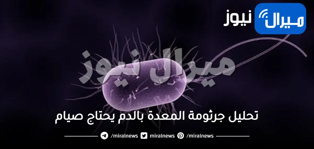 تحليل جرثومة المعدة بالدم يحتاج صيام