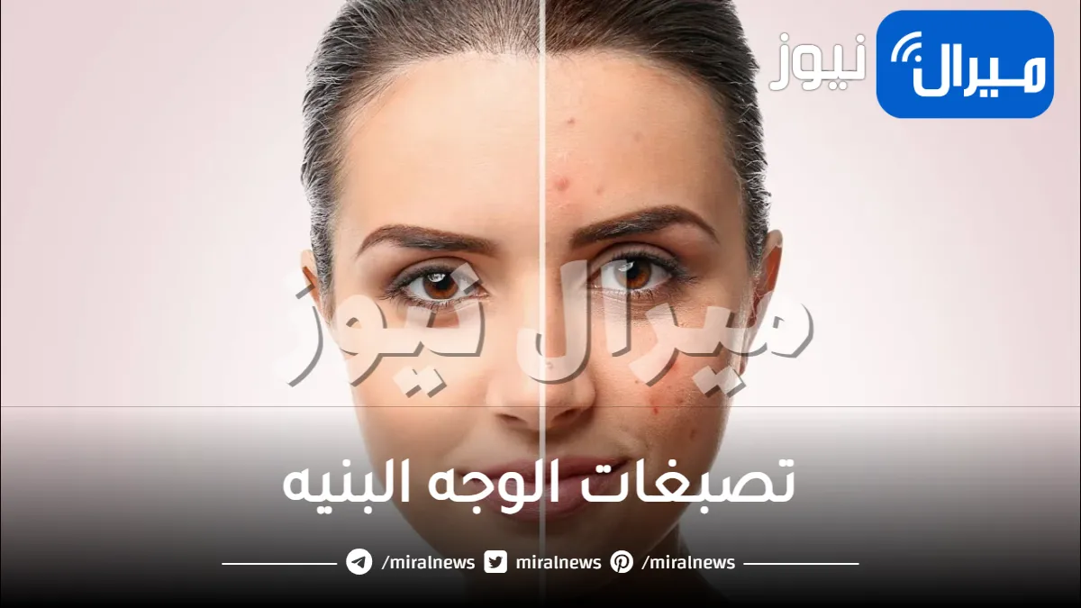 10 طرق للتخلص من تصبغات الوجه البنيه