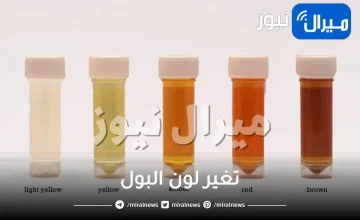 تغير لون البول